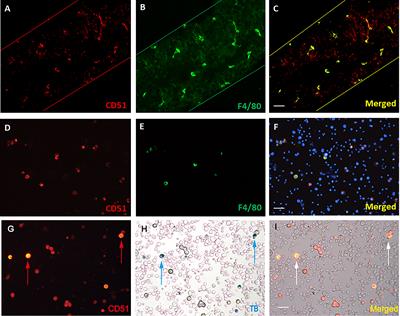 Effects of aging and macrophages on mice stem Leydig cell proliferation and differentiation in vitro